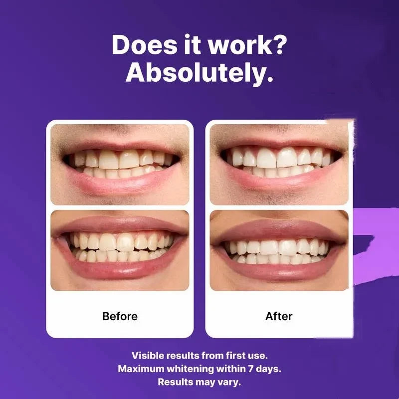 Purple Teeth Whitening Strips for Sensitive Teeth